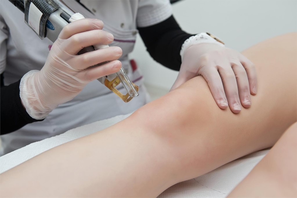 Laser mas efectivo para depilacion clearance