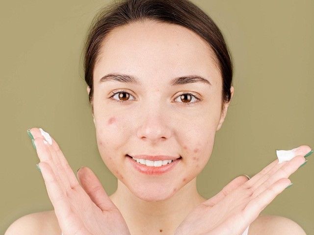 ¿Qué es el peeling químico y cuáles son sus beneficios?