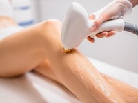 ¿Qué tipos de depilación láser existen?